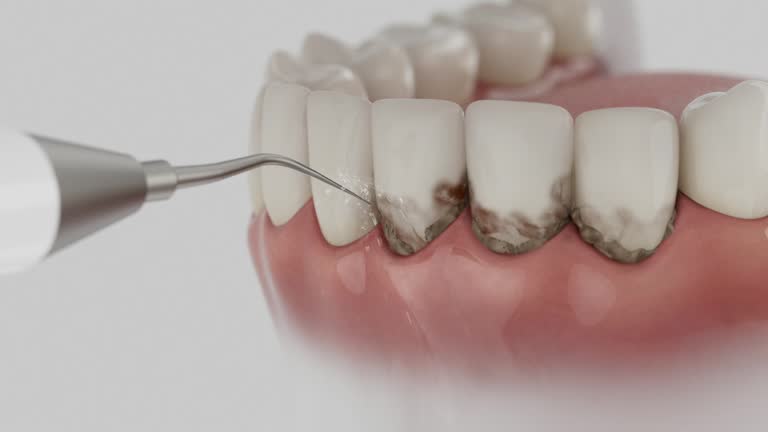 Reliable Dental Implants contractor in Ferrum, VA by Smile Center Dentistry